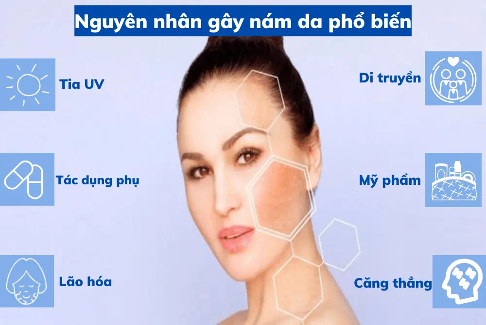 Nguyên nhân gây nám da phổ biến
