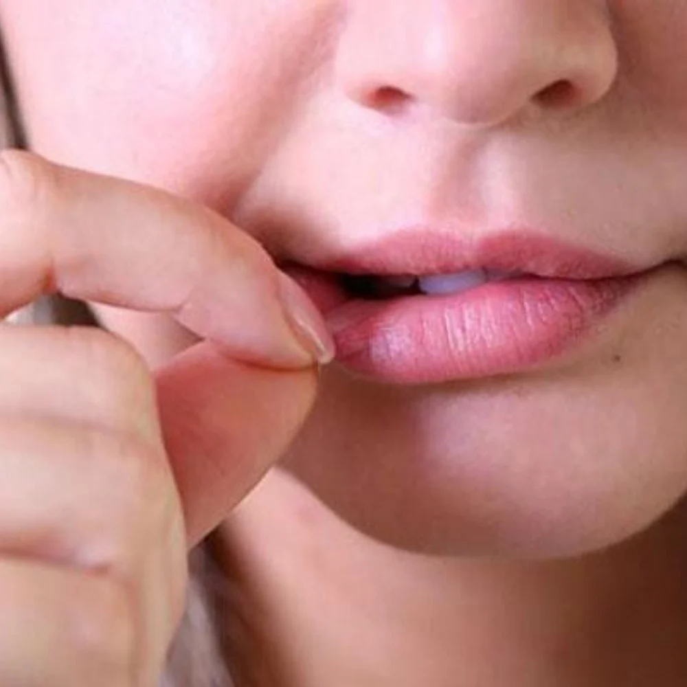 Ngứa và đau vùng môi Ngứa và đau vùng môi