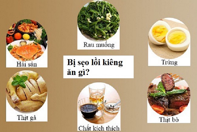 Ngoài trứng, bị sẹo lồi nên kiêng ăn gì?