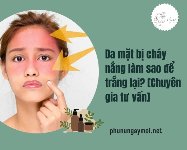 Da mặt bị cháy nắng làm sao để trắng lại