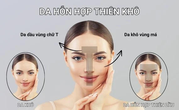 Cách nhận biết da hỗn hợp thiên khô
