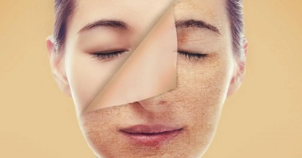 Những điều cần lưu ý khi skincare cho da hỗn hợp thiên khô