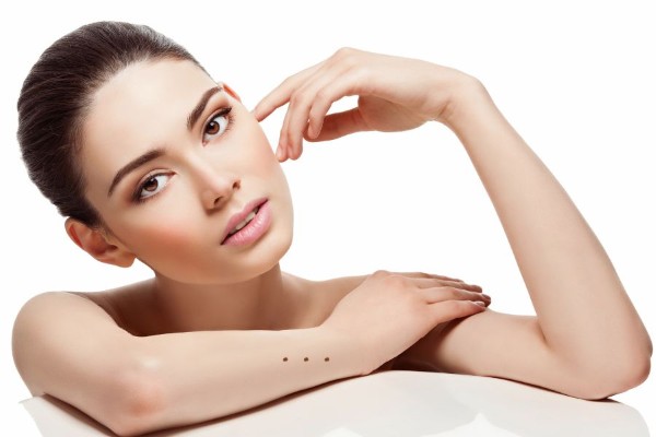 3 nốt ruồi thẳng hàng được xem là một dấu hiệu tốt nên không cần phải tẩy hoặc xóa đi