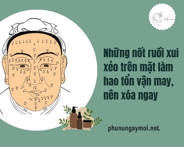 Những nốt ruồi xui xẻo trên mặt