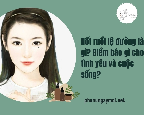 Nốt ruồi lệ