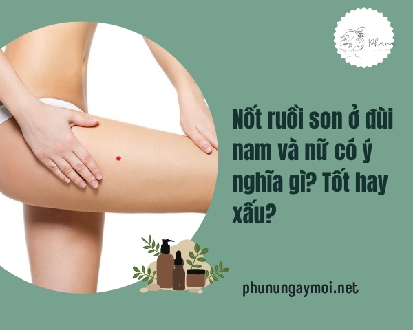 Nốt ruồi son ở đùi