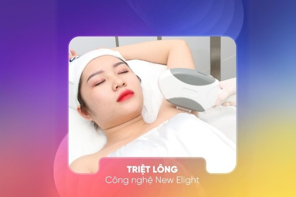Công nghệ triệt lông New E-light được nhiều chị em ưa chuộng Công nghệ triệt lông New E-light được nhiều chị em ưa chuộng