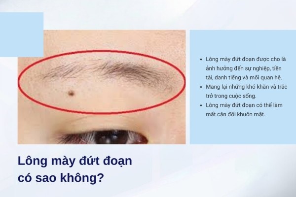 Lông mày đứt đoạn có sao không?