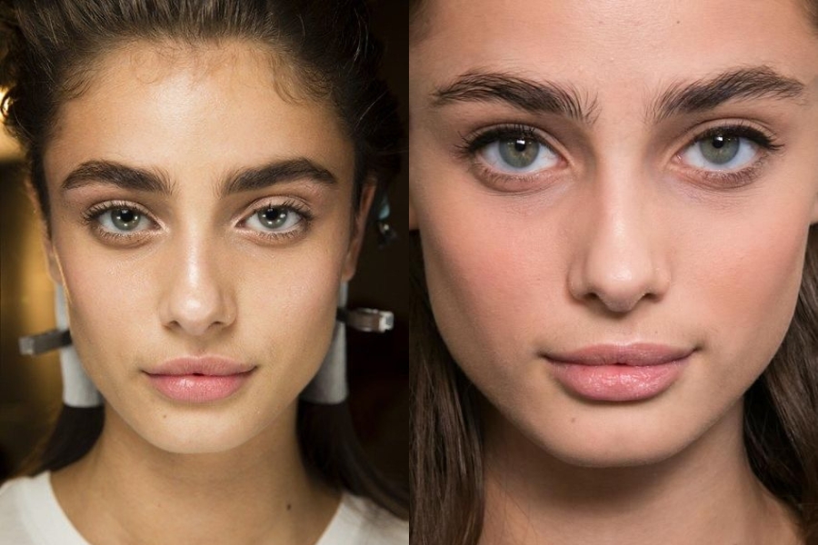 Triệt lông mày giao nhau bằng công nghệ laser hiện đại