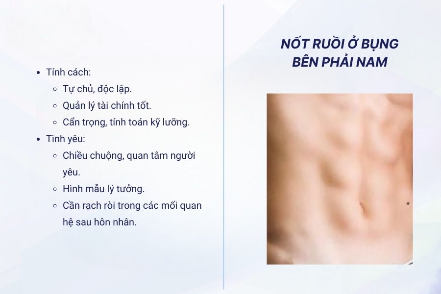 Nốt ruồi ở bụng bên phải khác gì so với nốt ruồi ở bên trái?