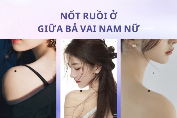 Nốt ruồi ở vai (giữa bả vai) – Điềm báo xấu cho nữ