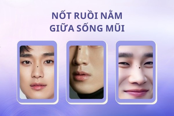 Những nốt ruồi xui xẻo trên mặt đàn ông – Nốt ruồi ngay sống mũi