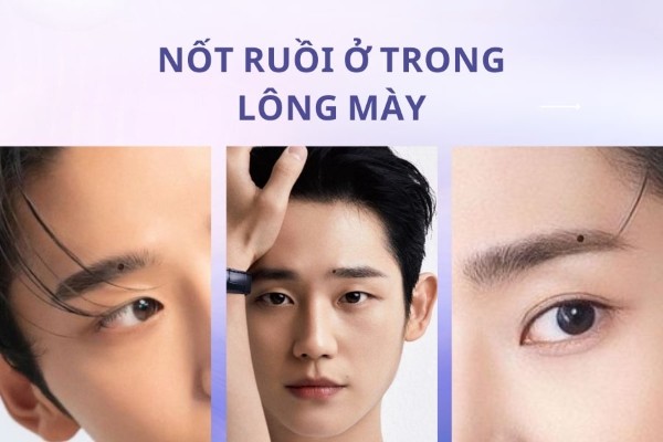 Những nốt ruồi xấu trên khuôn mặt đàn ông nên xóa ngay