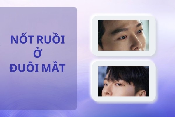 Nốt ruồi ở đuôi mắt – Nốt ruồi đen, hai đời vợ