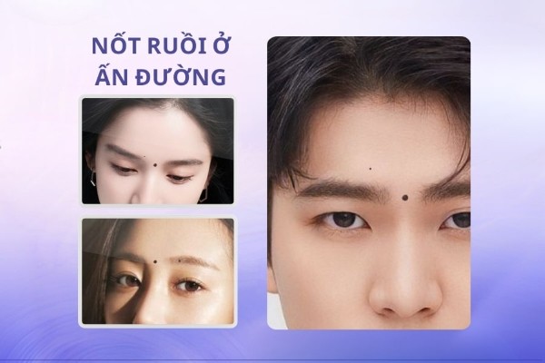 Nốt ruồi đen ở ấn đường – Lận đận tình duyên, sự nghiệp lao đao