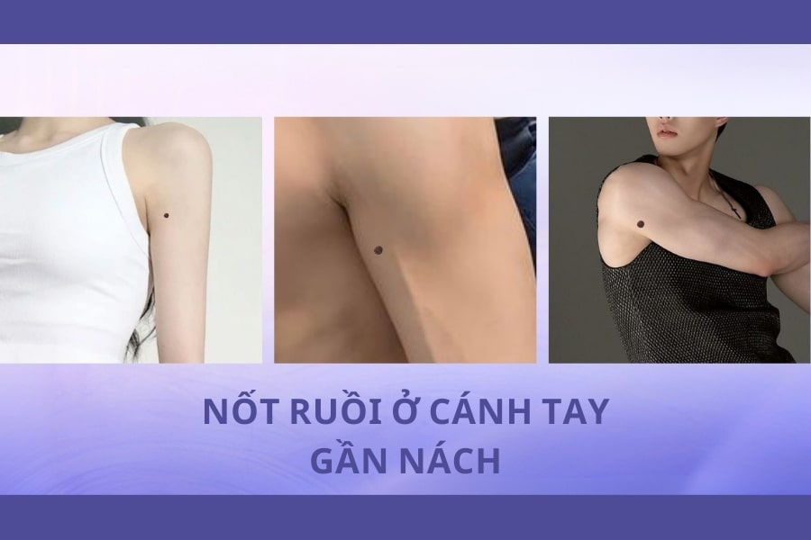 Nốt ruồi ở cánh tay gần nách – Cảnh báo về vấn đề tài chính