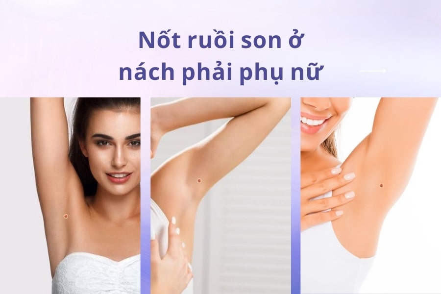 Nốt ruồi son ở nách phải của phụ nữ – Thông điệp của sự giàu sang