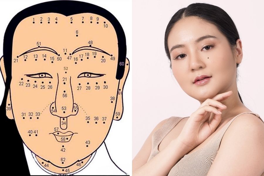 Nốt ruồi lệ là tốt hay xấu?