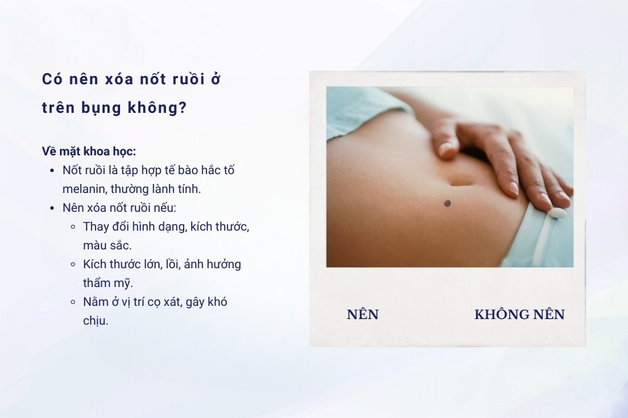Nốt ruồi trên bụng – Tốt hay xấu? Có nên xóa bỏ hay không?
