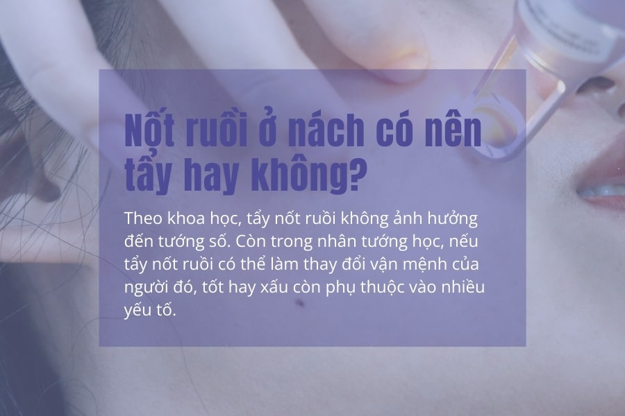Nốt ruồi ở nách tốt hay xấu, có nên tẩy hay không?