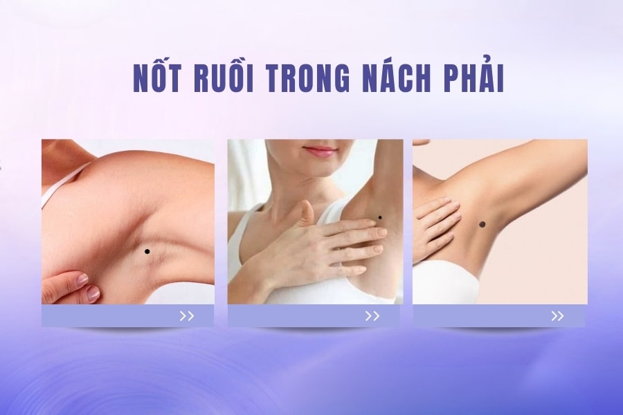 Nốt ruồi trong nách phải của nữ – Người thông minh, tháo vát