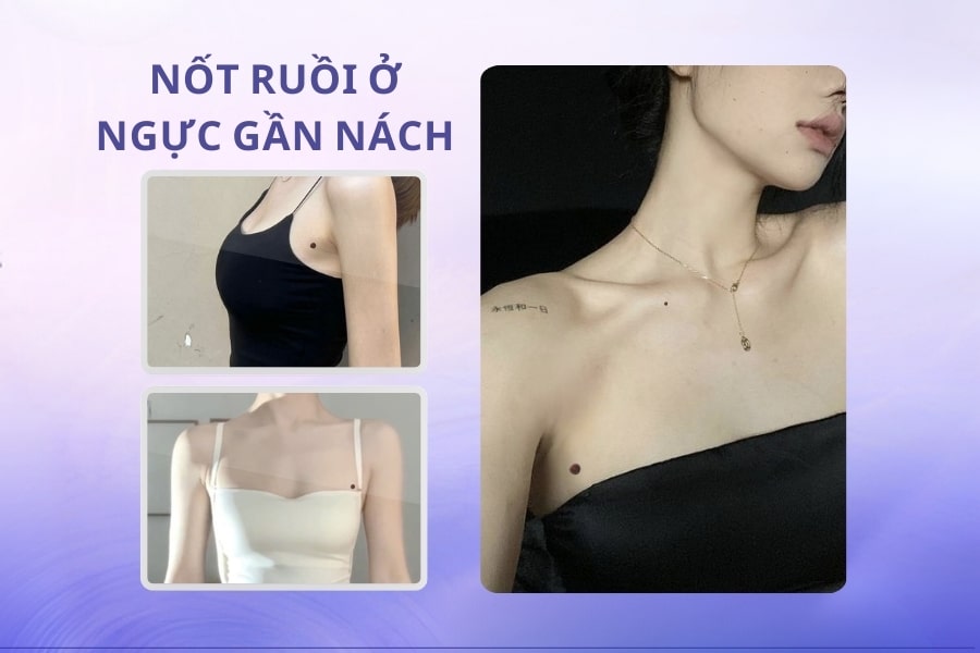 Nốt ruồi ở ngực gần nách – Số mệnh đại cát, đại quý