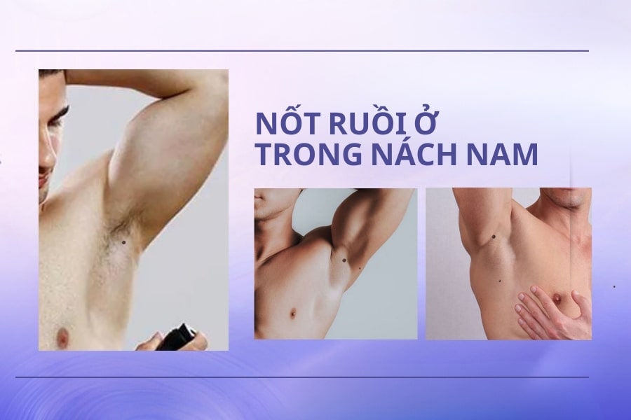 Nốt ruồi trong nách của đàn ông – Dấu hiệu của người cực kỳ may mắn