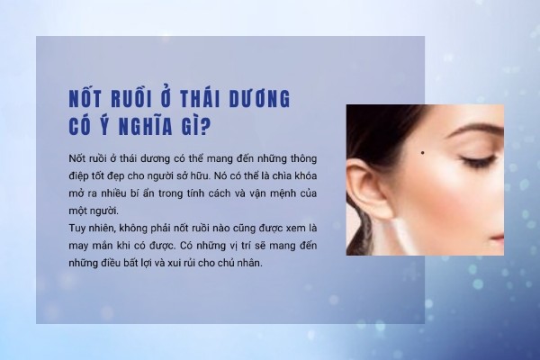 Nốt ruồi ở thái dương nam và nữ có ý nghĩa gì?