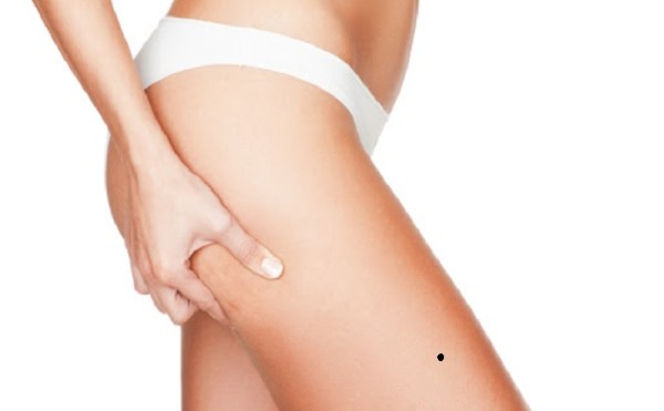 Nốt ruồi son ở đùi trước nữ – Cả tin, dễ bị lợi dụng Nốt ruồi son ở đùi trước nữ – Cả tin, dễ bị lợi dụng