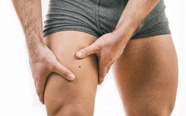 Nốt ruồi son ở sau đùi nam – Tinh thần tự do, yêu khám phá và sống theo cảm xúc Nốt ruồi son ở sau đùi nam – Tinh thần tự do, yêu khám phá và sống theo cảm xúc