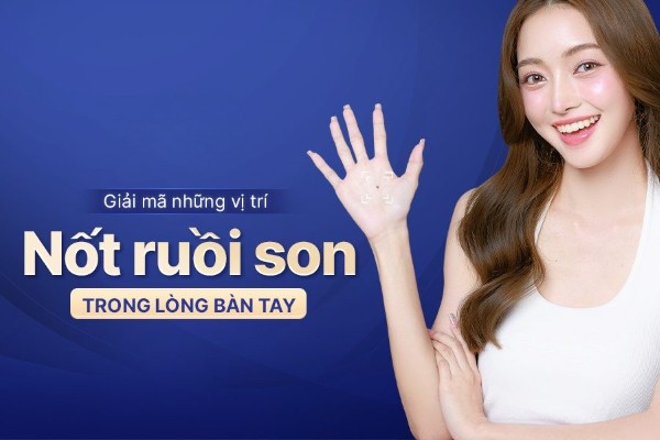 Nốt ruồi son trong lòng bàn tay mang đến những ý nghĩa gì?