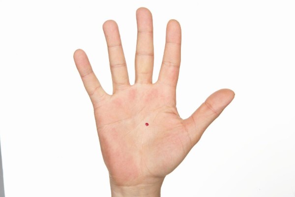 Nốt ruồi son ở lòng bàn tay cho thấy họ là những người thông minh và nhạy bén