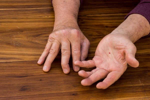 Nam giới có nốt ruồi son trong lòng bàn tay trái là người thích kết bạn, luôn hết mình với công việc