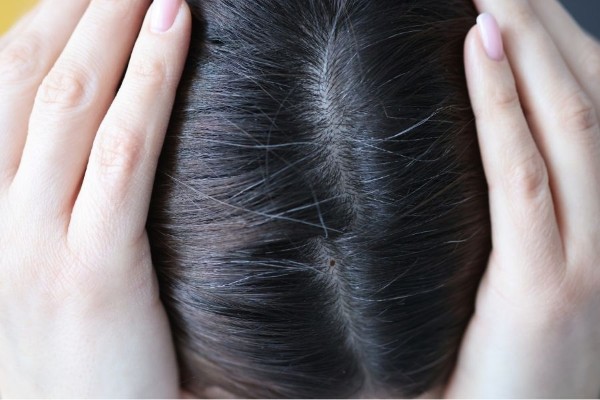 Phụ nữ sở hữu nốt ruồi đỉnh đầu thường linh hoạt và giỏi việc nhà Phụ nữ sở hữu nốt ruồi đỉnh đầu thường linh hoạt và giỏi việc nhà