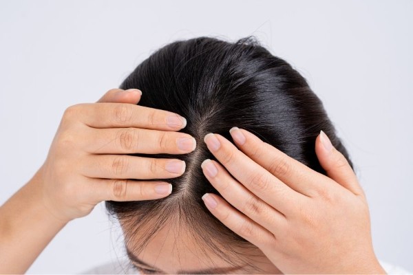 Những người sở hữu nốt ruồi ở đỉnh đầu phía bên trái thường gặp phải nhiều tổn thất về mặt tài chính Những người sở hữu nốt ruồi ở đỉnh đầu phía bên trái thường gặp phải nhiều tổn thất về mặt tài chính