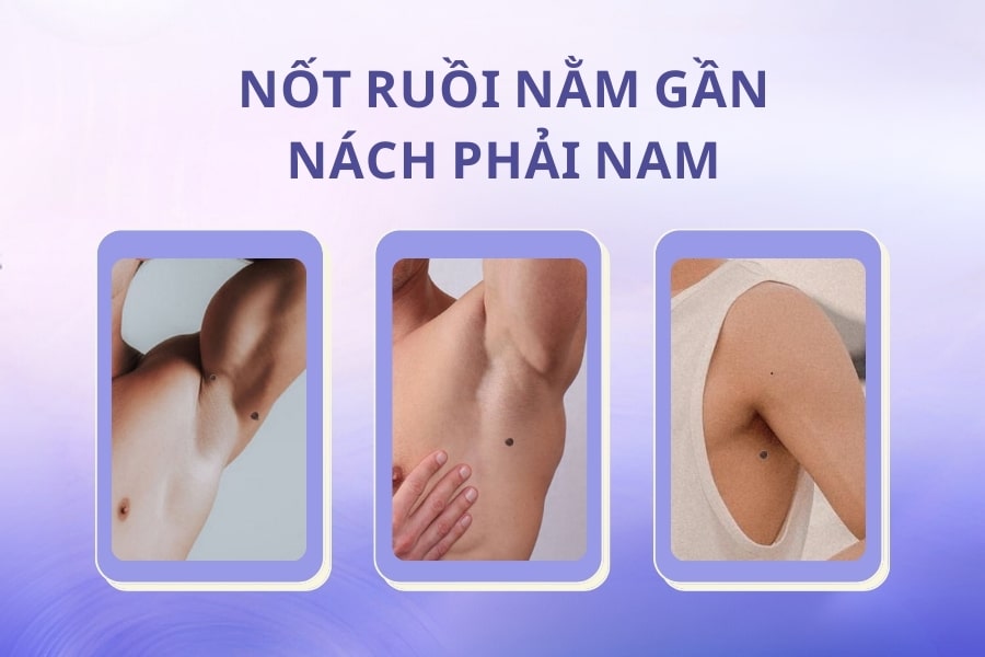 Nốt ruồi gần nách phải của đàn ông – Người của nghệ thuật