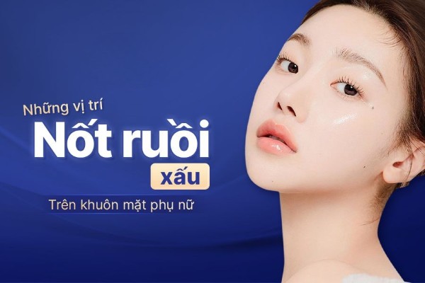 Những vị trí nốt ruốt xấu trên khuôn mặt phụ nữ cần lưu ý