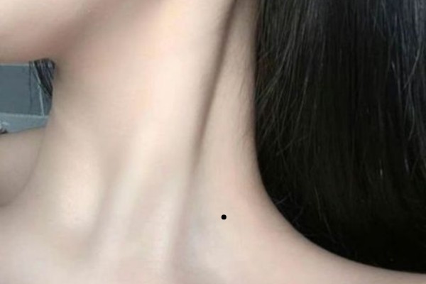 Nốt ruồi ở phía bên trái cổ – Lấy chồng muộn đỡ lao đao