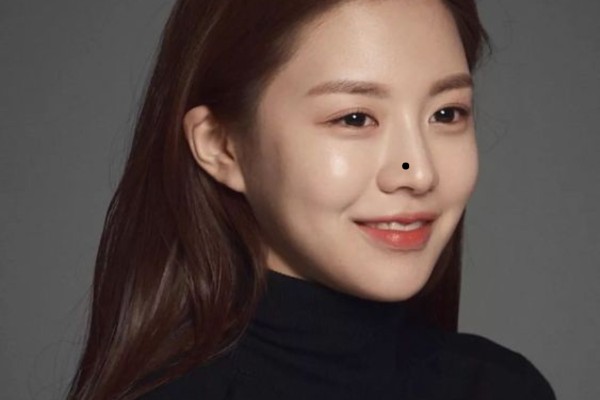 Nốt ruồi trên mũi – Dễ yêu, dễ cưới, dễ đổ vỡ