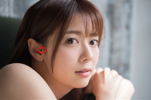 Nốt ruồi ở bình nhĩ – Một dạ, hai lòng trong tình yêu