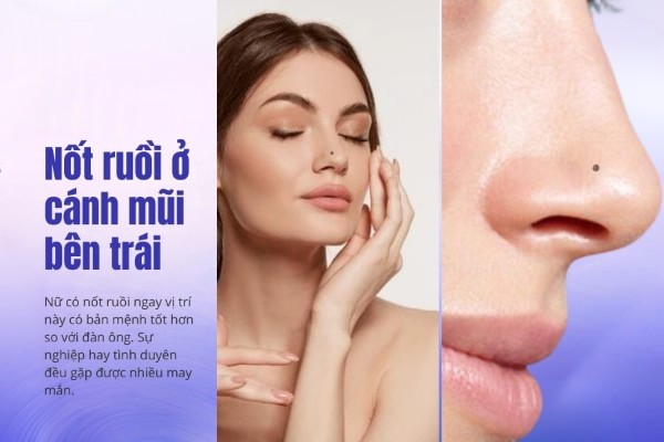Nốt ruồi ở cánh mũi bên trái nam xấu hơn nữ