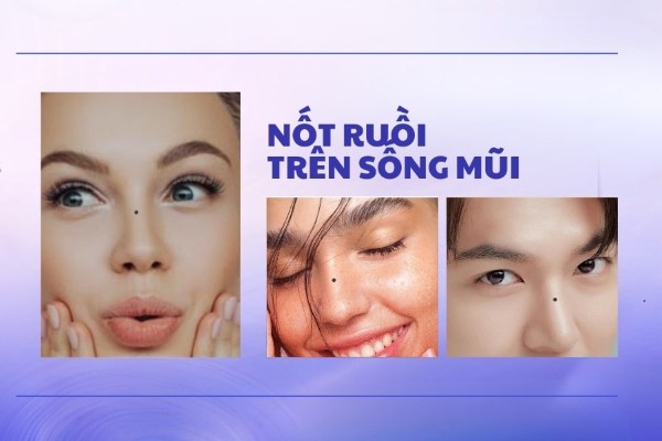 Nốt ruồi sống mũi – Nam nữ đều có vấn đề sức khỏe yếu kém