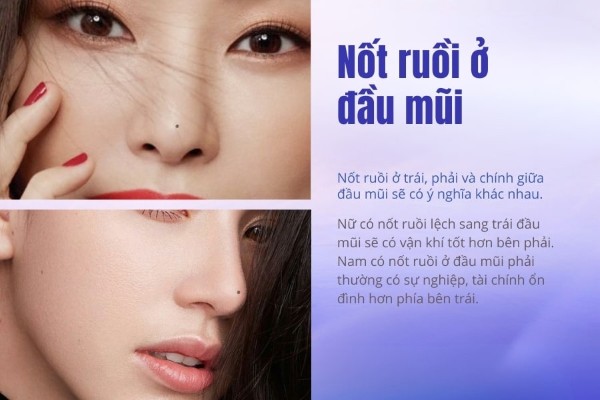 Nốt ruồi trên mũi – Tùy theo vị trí xuất hiện mà ý nghĩa sẽ khác nhau