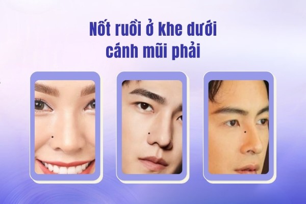 Nốt ruồi ở mũi nữ, khe dưới cánh mũi mang ý nghĩa xấu
