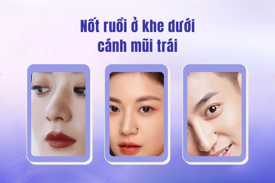 Nốt ruồi ở khe mũi, dưới cánh mũi trái – Nữ khôn ngoan, nam nóng nảy