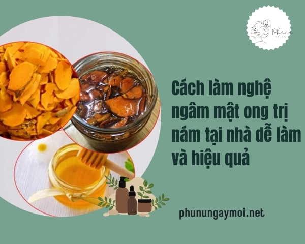 Cách làm nghệ ngâm mật ong trị nám