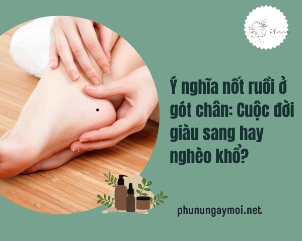 nốt ruồi ở gót chân
