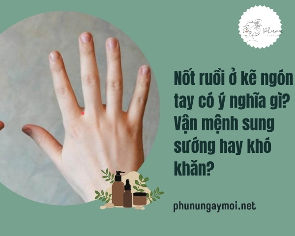 Nốt ruồi ở kẽ ngón tay