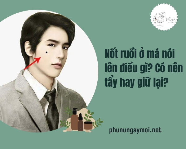 Nốt ruồi ở má