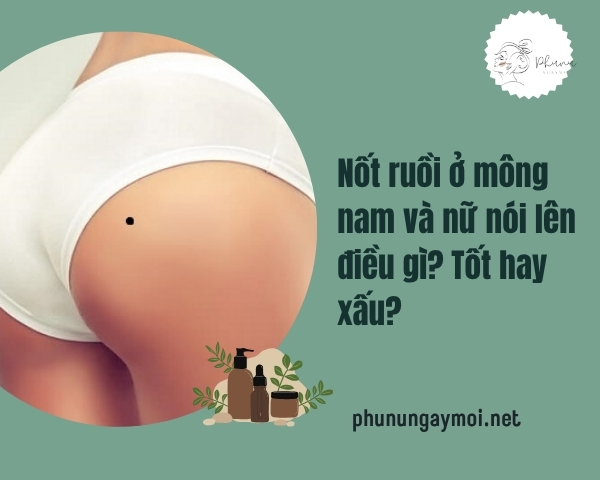 Nốt ruồi ở mông
